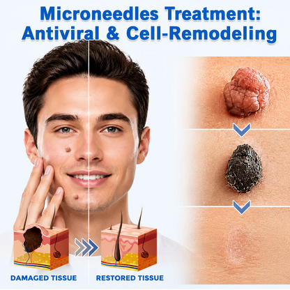 🎉𝑯𝒊𝒔𝒌𝒊𝒏® 2-in-1 Microneedle & Hydrocolloid Patch | Removes raised moles, acne, flat warts, and skin tags | Helps improve wrinkles, scars, and blemishes | Invisible patches for face and body