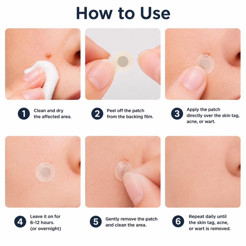 🎉𝑯𝒊𝒔𝒌𝒊𝒏® 2-in-1 Microneedle & Hydrocolloid Patch | Removes raised moles, acne, flat warts, and skin tags | Helps improve wrinkles, scars, and blemishes | Invisible patches for face and body